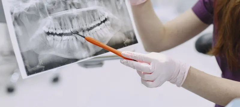 Dentist explaining dental X-ray results during treatment planning